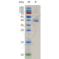 Human TGFBR1 Protein, hFc Tag – Figure 1 of 1