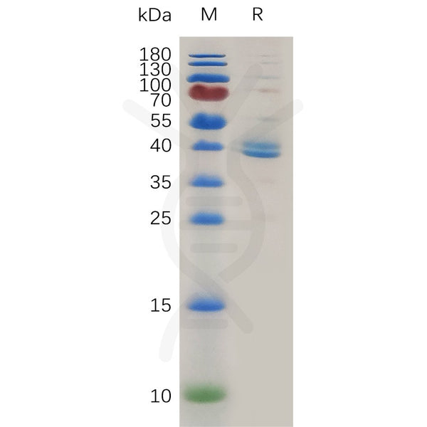 Human TGFBR1 Protein, hFc Tag – Figure 1 of 1