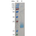 Human CD3D Protein, His Tag – Figure 1 of 1