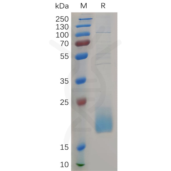 Human CD3D Protein, His Tag – Figure 1 of 1