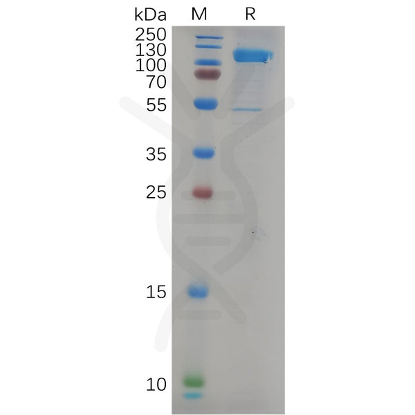 Human CDH17 Protein, His Tag – Figure 1 of 1