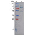 Human CDH3 Protein, His Tag – Figure 1 of 1