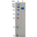 Human GPA33 Protein, hFc Tag – Figure 1 of 1