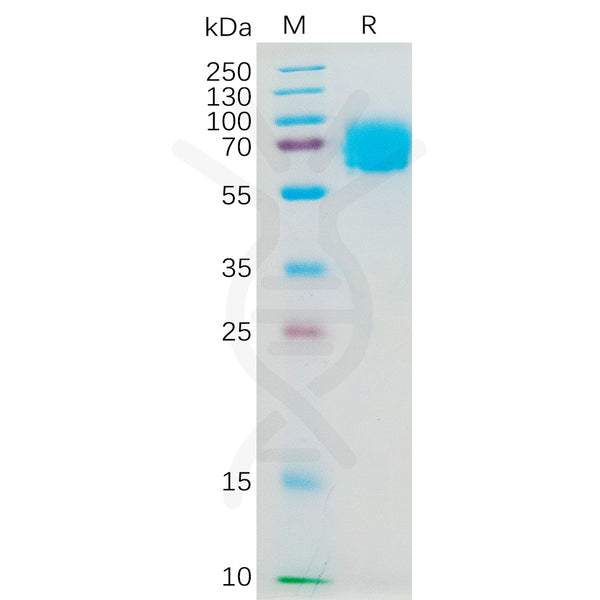 Human IL4RA Protein, hFc Tag – Figure 1 of 1