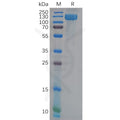Human ANPEP Protein, His Tag – Figure 1 of 1