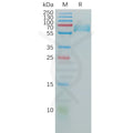 Human CD147 Protein, hFc Tag – Figure 1 of 1