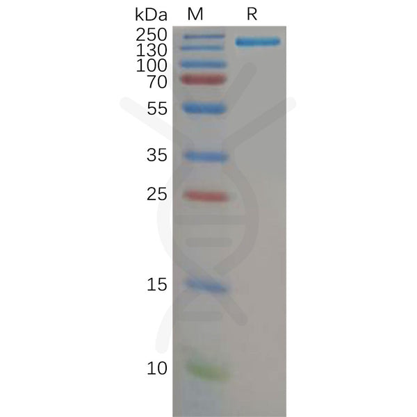 Human CD21 Protein, hFc Tag – Figure 1 of 1