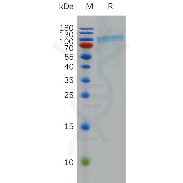 Human CD39 Protein, hFc Tag – Figure 1 of 1