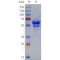 Human CD8A Acidic tail Protein, hFc Tag – Figure 1 of 1