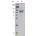 Human CXCR1 Protein, hFc Tag – Figure 1 of 1