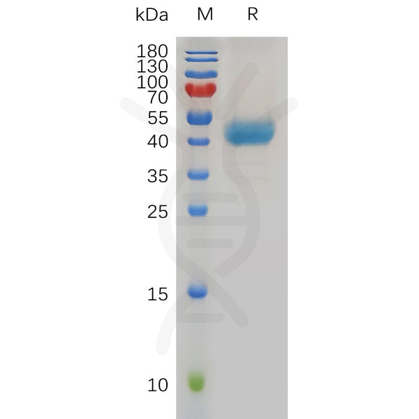 Human CXCR1 Protein, hFc Tag – Figure 1 of 1