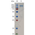Human MST1R Protein, hFc Tag – Figure 1 of 1
