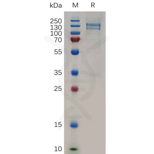 Human MST1R Protein, hFc Tag – Figure 1 of 1