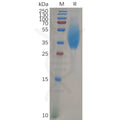 Human CEACAM6 Protein, His Tag – Figure 1 of 1