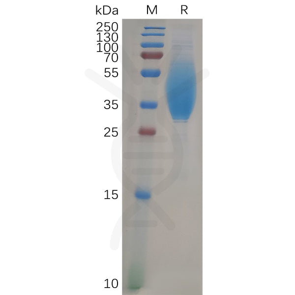 Human CEACAM6 Protein, His Tag – Figure 1 of 1