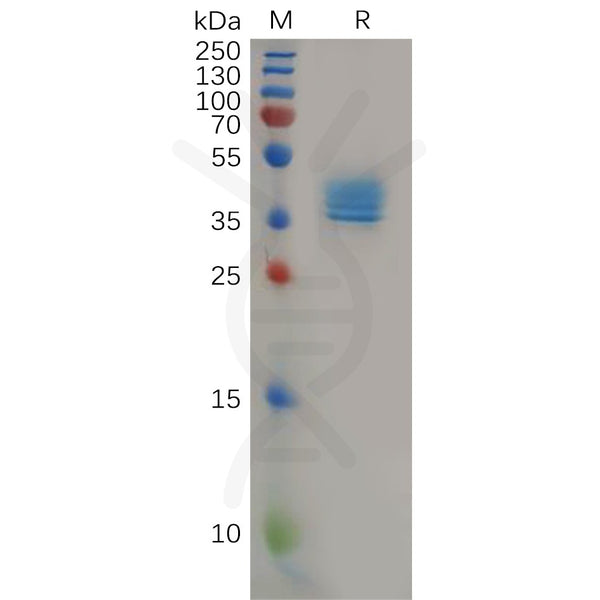 Human CCR4 (1-39) Protein, hFc Tag – Figure 1 of 1