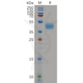 Human CCR7 Protein, hFc Tag – Figure 1 of 1