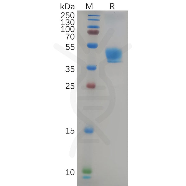 Human CCR9 Protein, hFc Tag – Figure 1 of 1