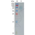 Human CD200R1 Protein, His Tag – Figure 1 of 1