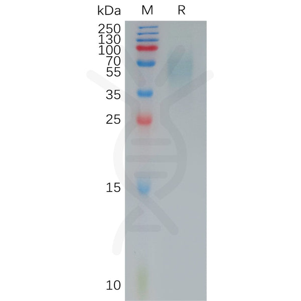 Human CD200R1 Protein, His Tag – Figure 1 of 1