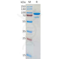 Human CD73 Protein, hFc Tag – Figure 1 of 1