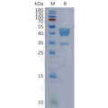Human C5AR1 Protein, hFc Tag – Figure 1 of 1