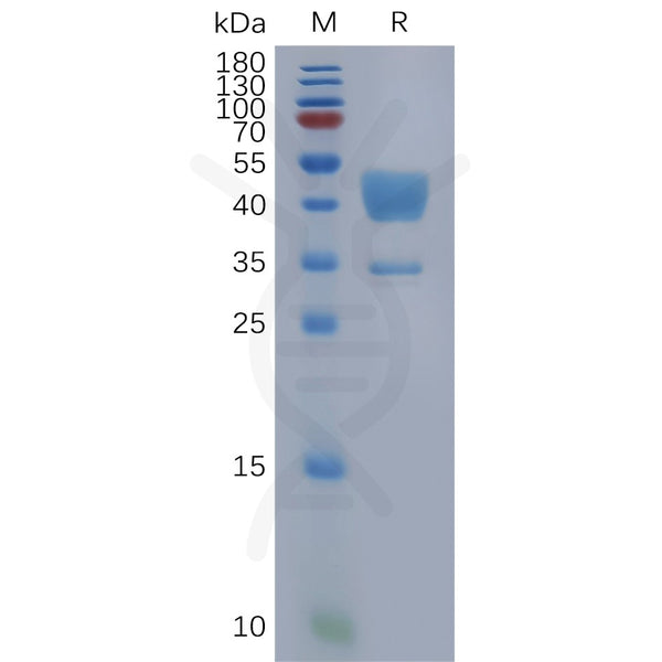 Human C5AR1 Protein, hFc Tag – Figure 1 of 1