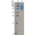 Human CEACAM1 Protein,His Tag – Figure 1 of 1