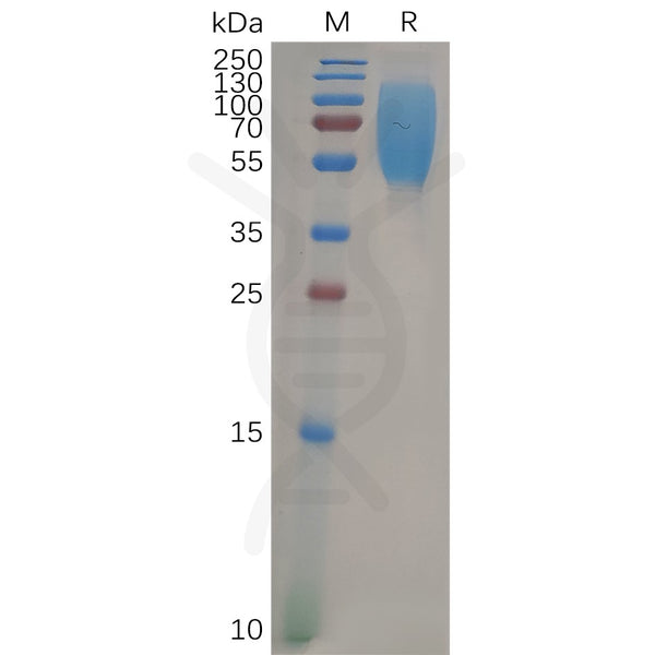 Human CEACAM1 Protein,His Tag – Figure 1 of 1