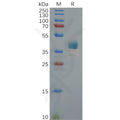 Human CXCR3 Protein, hFc Tag – Figure 1 of 1