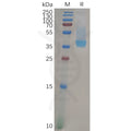 Human CXCR4 Protein, hFc Tag – Figure 1 of 1