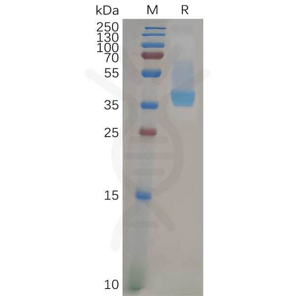 Human CXCR4 Protein, hFc Tag – Figure 1 of 1