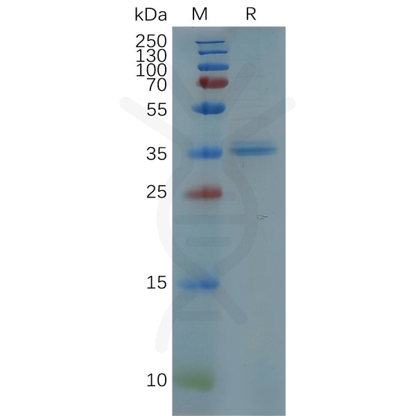 Human CXCR5 Protein, hFc Tag – Figure 1 of 1