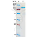 Human LRRC32 Protein, hFc Tag – Figure 1 of 1