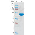Human IL1B Protein, hFc Tag – Figure 1 of 1
