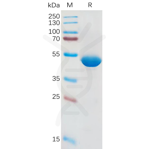 Human IL1B Protein, hFc Tag – Figure 1 of 1
