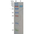 Human IL7RA Protein, hFc Tag – Figure 1 of 1