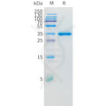 Human IL8 Protein, hFc Tag – Figure 1 of 1