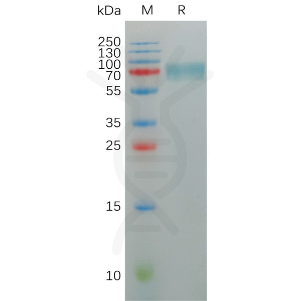 Human KIR2DL2 Protein, hFc Tag – Figure 1 of 1