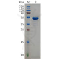 Human CD99 Protein, hFc Tag – Figure 1 of 1