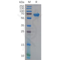 Human NCR1 Protein, hFc Tag – Figure 1 of 1