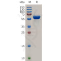 Human TNFRSF11A Protein, hFc Tag – Figure 1 of 1