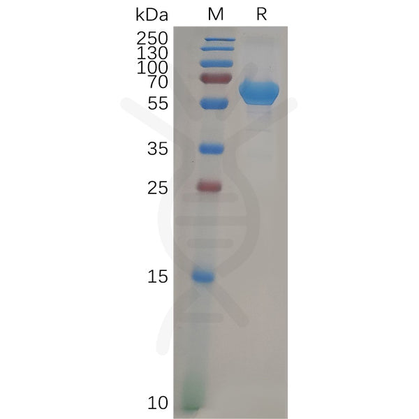 Human VSIG4 Protein, hFc Tag – Figure 1 of 1