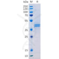 Human PROM1 Protein, hFc Tag – Figure 1 of 1