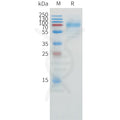 Human CD1A Protein, hFc Tag – Figure 1 of 1