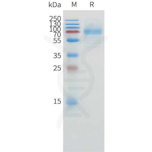 Human CD1A Protein, hFc Tag – Figure 1 of 1