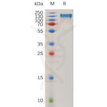 Human ITGAV and ITGB1 Heterodimer Protein, His Tag and hFc Tag – Figure 1 of 1