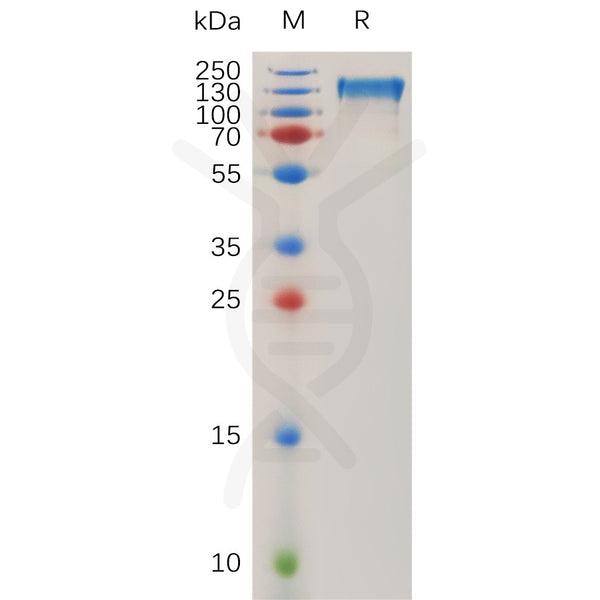 Human ITGAV and ITGB1 Heterodimer Protein, His Tag and hFc Tag – Figure 1 of 1