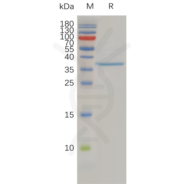 Human CLDN3 Protein, hFc Tag – Figure 1 of 1