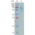 Human COLEC10 Protein, hFc Tag – Figure 1 of 1